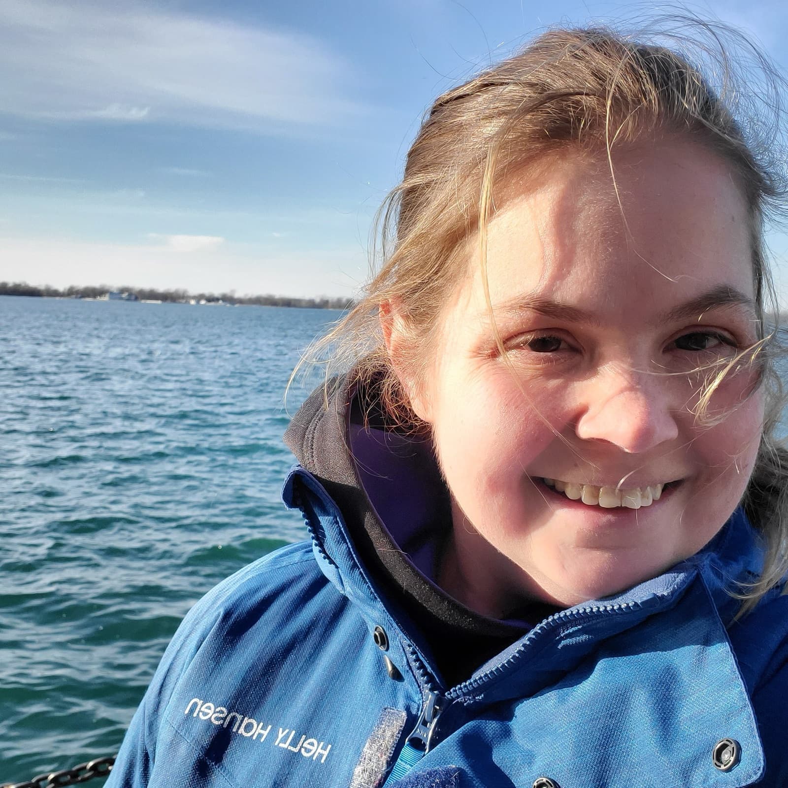A woman with Blau syndrome smiling on a boat, lake and sky behind her